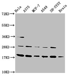 DAZAP2 Antibody - Western Blot Positive WB detected in: Hela whole cell lysate, A375 whole cell lysate, MCF-7 whole cell lysate, A549 whole cell lysate, SH-SY5Y whole cell lysate, Rat brain tissue All Lanes: DAZAP2 antibody at 3.5µg/ml Secondary Goat polyclonal to rabbit IgG at 1/50000 dilution Predicted band size: 18, 17, 16, 14, 10, 23 KDa Observed band size: 18 KDa