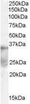 DAZL Antibody - Antibody (0.1 ug/ml) staining of human ovary lysate (35 ug protein in RIPA buffer). Primary incubation was 1 hour. Detected by chemiluminescence.