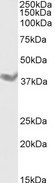 DAZL Antibody - DAZL antibody (1µg/ml) staining of Rat Testes lysate (35µg protein in RIPA buffer). Primary incubation was 1 hour. Detected by chemiluminescence.