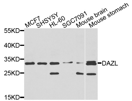DAZL Antibody - Western blot analysis of extracts of various cell lines, using DAZL antibody at 1:1000 dilution. The secondary antibody used was an HRP Goat Anti-Rabbit IgG (H+L) at 1:10000 dilution. Lysates were loaded 25ug per lane and 3% nonfat dry milk in TBST was used for blocking. An ECL Kit was used for detection and the exposure time was 30s.