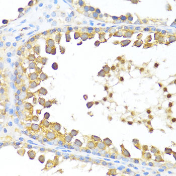 DAZL Antibody - Immunohistochemistry of paraffin-embedded rat testis using DAZL antibody at dilution of 1:100 (40x lens).