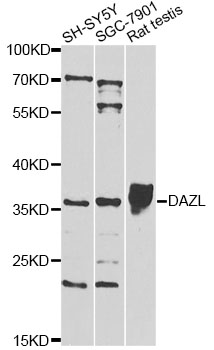 DAZL Antibody - Western blot analysis of extracts of various cell lines, using DAZL antibody at 1:1000 dilution. The secondary antibody used was an HRP Goat Anti-Rabbit IgG (H+L) at 1:10000 dilution. Lysates were loaded 25ug per lane and 3% nonfat dry milk in TBST was used for blocking. An ECL Kit was used for detection and the exposure time was 30s.
