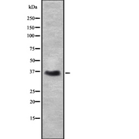 DAZL Antibody - Western blot analysis of DAZL using Jurkat whole cells lysates