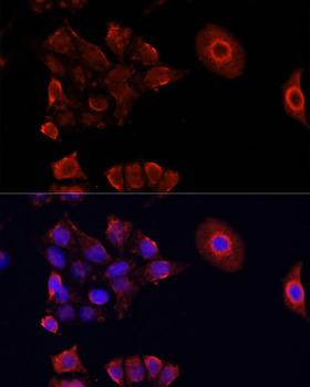 DAZL Antibody - Immunofluorescence analysis of HeLa cells using DAZL Polyclonal Antibody at dilution of 1:100.Blue: DAPI for nuclear staining.