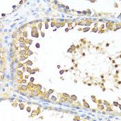 DAZL Antibody - Immunohistochemistry of paraffin-embedded Rat testis using DAZL Polyclonal Antibody at dilution of 1:100 (40x lens).