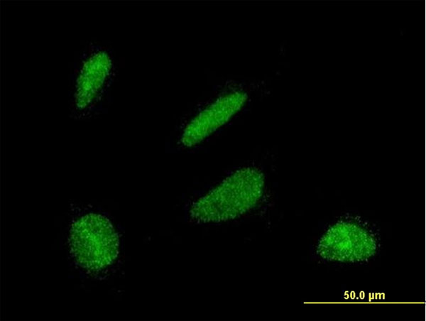 DBF4 Antibody - Immunofluorescence of monoclonal antibody to DBF4 on HeLa cell. [antibody concentration 10 ug/ml].