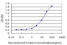 DBF4 Antibody - Detection limit for recombinant GST tagged DBF4 is approximately 0.1 ng/ml as a capture antibody.