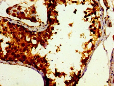 DBF4 Antibody - Immunohistochemistry image of paraffin-embedded human testis tissue at a dilution of 1:100
