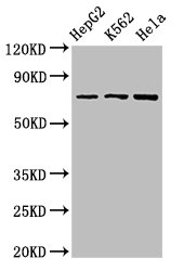DBF4 Antibody - Positive Western Blot detected in HepG2 whole cell lysate, K562 whole cell lysate, Hela whole cell lysate. All lanes: DBF4 antibody at 2.7 µg/ml Secondary Goat polyclonal to rabbit IgG at 1/50000 dilution. Predicted band size: 77, 27 KDa. Observed band size: 77 KDa