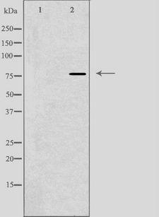 DBF4 Antibody - Western blot analysis of extracts of NIH-3T3 cells treated with H2O2 using DBF4 antibody. The lane on the left is treated with the antigen-specific peptide.