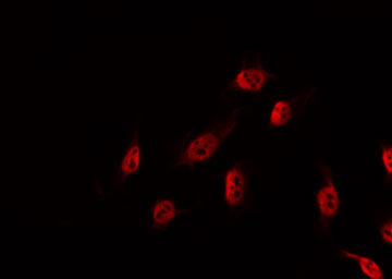 DBF4 Antibody - Staining NIH-3T3 cells by IF/ICC. The samples were fixed with PFA and permeabilized in 0.1% Triton X-100, then blocked in 10% serum for 45 min at 25°C. The primary antibody was diluted at 1:200 and incubated with the sample for 1 hour at 37°C. An Alexa Fluor 594 conjugated goat anti-rabbit IgG (H+L) Ab, diluted at 1/600, was used as the secondary antibody.