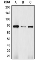 DBF4 Antibody - Western blot analysis of DBF4 expression in Jurkat (A); HepG2 (B); SW480 (C) whole cell lysates.
