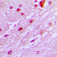 DBF4 Antibody - Immunohistochemical analysis of DBF4 staining in human brain formalin fixed paraffin embedded tissue section. The section was pre-treated using heat mediated antigen retrieval with sodium citrate buffer (pH 6.0). The section was then incubated with the antibody at room temperature and detected using an HRP conjugated compact polymer system. DAB was used as the chromogen. The section was then counterstained with hematoxylin and mounted with DPX.