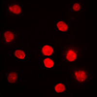 DBF4 Antibody - Immunofluorescent analysis of DBF4 staining in HepG2 cells. Formalin-fixed cells were permeabilized with 0.1% Triton X-100 in TBS for 5-10 minutes and blocked with 3% BSA-PBS for 30 minutes at room temperature. Cells were probed with the primary antibody in 3% BSA-PBS and incubated overnight at 4 C in a humidified chamber. Cells were washed with PBST and incubated with a DyLight 594-conjugated secondary antibody (red) in PBS at room temperature in the dark. DAPI was used to stain the cell nuclei (blue).