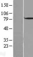 DBF4 Protein - Western validation with an anti-DDK antibody * L: Control HEK293 lysate R: Over-expression lysate
