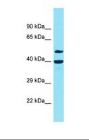 DBF4B / DRF1 Antibody - Western blot of NCI-H226 Whole Cell. DCAF10 antibody dilution 1.0 ug/ml.  This image was taken for the unconjugated form of this product. Other forms have not been tested.