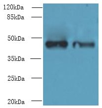DBF4B / DRF1 Antibody - Western blot. All lanes: DBF4B antibody at 4 ug/ml. Lane 1: MCF7 whole cell lysate. Lane 2: A549 whole cell lysate. Secondary Goat polyclonal to Rabbit IgG at 1:10000 dilution. Predicted band size: 47 kDa. Observed band size: 47 kDa.