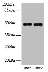 DBF4B / DRF1 Antibody - Western blot All lanes: DBF4B antibody at 4µg/ml Lane 1: MCF-7 whole cell lysate Lane 2: A549 whole cell lysate Secondary Goat polyclonal to rabbit IgG at 1/10000 dilution Predicted band size: 68, 48, 55, 19 kDa Observed band size: 48 kDa