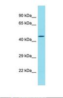DBF4B / DRF1 Antibody - Western blot of Human HeLa. DBF4B antibody dilution 1.0 ug/ml.  This image was taken for the unconjugated form of this product. Other forms have not been tested.