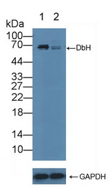 DBH/Dopamine Beta Hydroxylase Antibody - Knockout Varification: Lane 1: Wild-type Hela cell lysate; Lane 2: DbH knockout Hela cell lysate; Predicted MW: 69kd Observed MW: 69kd Primary Ab: 5µg/ml Rabbit Anti-Human DbH Antibody Second Ab: 0.2µg/mL HRP-Linked Caprine Anti-Rabbit IgG Polyclonal Antibody