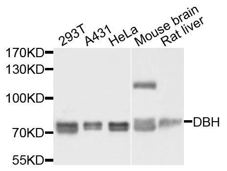 DBH/Dopamine Beta Hydroxylase Antibody - Western blot analysis of extracts of various cells.