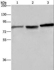 DBH/Dopamine Beta Hydroxylase Antibody - Western blot analysis of Mouse brain tissue, A172 and HeLa cell, using DBH Polyclonal Antibody at dilution of 1:200.