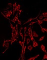 DBH/Dopamine Beta Hydroxylase Antibody - Staining HeLa cells by IF/ICC. The samples were fixed with PFA and permeabilized in 0.1% Triton X-100, then blocked in 10% serum for 45 min at 25°C. The primary antibody was diluted at 1:200 and incubated with the sample for 1 hour at 37°C. An Alexa Fluor 594 conjugated goat anti-rabbit IgG (H+L) Ab, diluted at 1/600, was used as the secondary antibody.