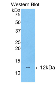 DBI / ACBD1 Antibody - Western blot of recombinant EP / DBI.  This image was taken for the unconjugated form of this product. Other forms have not been tested.