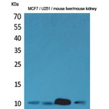 DBI / ACBD1 Antibody - Western blot of ACBP antibody