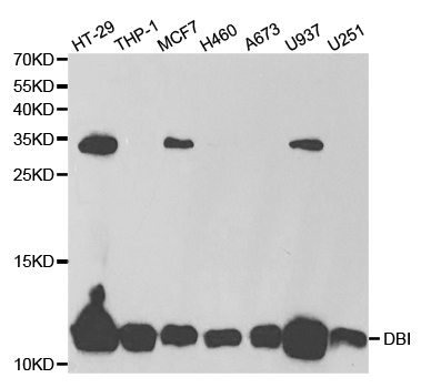 DBI / ACBD1 Antibody - Western blot analysis of extracts of various cell lines.