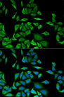 DBI / ACBD1 Antibody - Immunofluorescence analysis of MCF-7 cells.