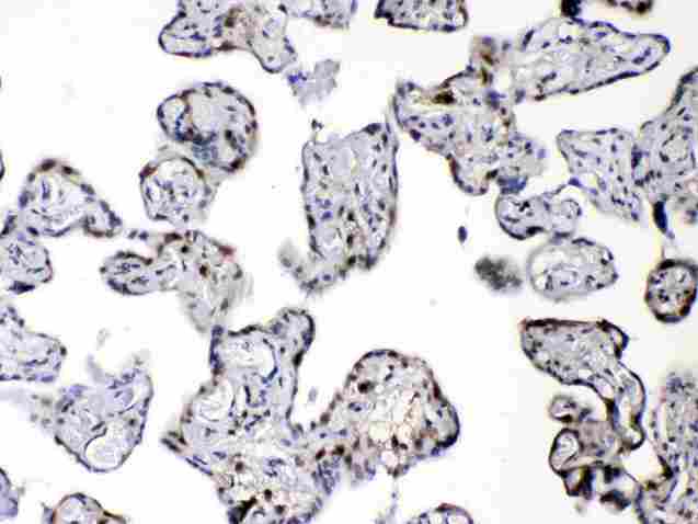 DBI / ACBD1 Antibody - IHC analysis of DBI using anti-DBI antibody. DBI was detected in paraffin-embedded section of human placenta tissues. Heat mediated antigen retrieval was performed in citrate buffer (pH6, epitope retrieval solution) for 20 mins. The tissue section was blocked with 10% goat serum. The tissue section was then incubated with 1µg/ml rabbit anti-DBI Antibody overnight at 4°C. Biotinylated goat anti-rabbit IgG was used as secondary antibody and incubated for 30 minutes at 37°C. The tissue section was developed using Strepavidin-Biotin-Complex (SABC) with DAB as the chromogen.