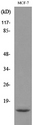 DBI / ACBD1 Antibody - Western blot analysis of lysate from MCF7 cells, using DBI Antibody.