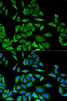 DBI / ACBD1 Antibody - Immunofluorescence analysis of MCF-7 cells using DBI antibody. Blue: DAPI for nuclear staining.