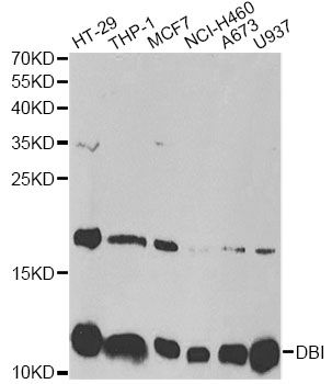 DBI / ACBD1 Antibody - Western blot analysis of extracts of various cell lines, using DBI antibody at 1:1000 dilution. The secondary antibody used was an HRP Goat Anti-Rabbit IgG (H+L) at 1:10000 dilution. Lysates were loaded 25ug per lane and 3% nonfat dry milk in TBST was used for blocking. An ECL Kit was used for detection and the exposure time was 90s.