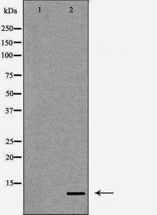 DBI / ACBD1 Antibody - Western blot analysis of extracts of HeLa cells using DBI antibody. The lane on the left is treated with the antigen-specific peptide.
