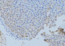 DBI / ACBD1 Antibody - 1:100 staining mouse liver tissue by IHC-P. The sample was formaldehyde fixed and a heat mediated antigen retrieval step in citrate buffer was performed. The sample was then blocked and incubated with the antibody for 1.5 hours at 22°C. An HRP conjugated goat anti-rabbit antibody was used as the secondary.