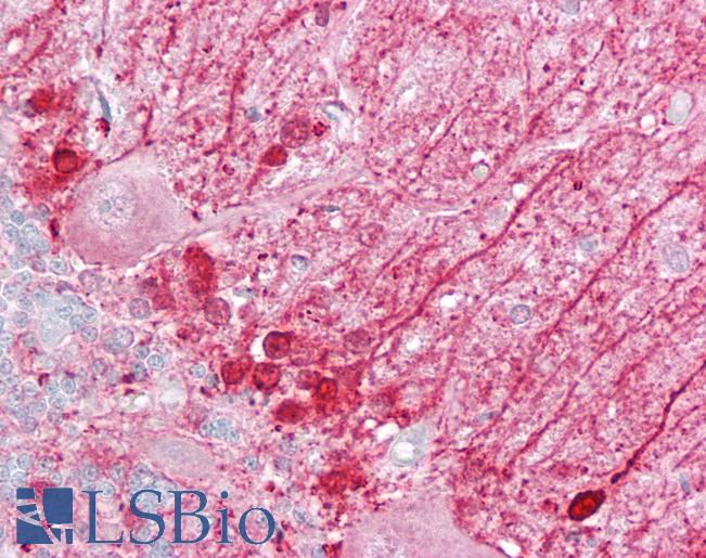 DBI / ACBD1 Antibody - Anti-DBI antibody IHC of human brain, cerebellum. Immunohistochemistry of formalin-fixed, paraffin-embedded tissue after heat-induced antigen retrieval. Antibody concentration 5 ug/ml.  This image was taken for the unconjugated form of this product. Other forms have not been tested.