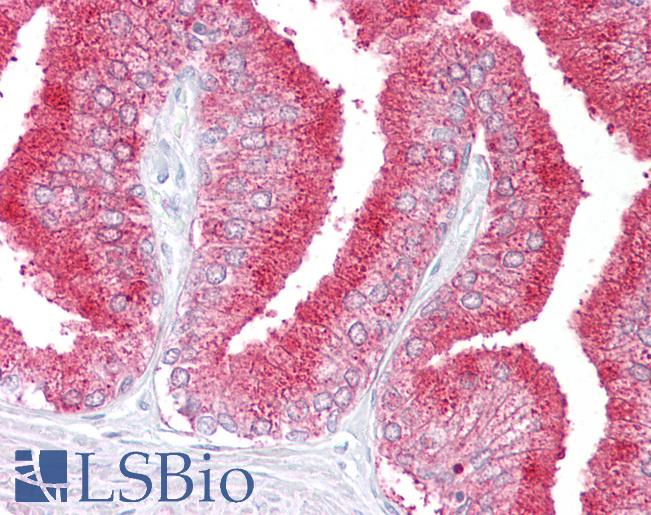 DBI / ACBD1 Antibody - Human Prostate: Formalin-Fixed, Paraffin-Embedded (FFPE).  This image was taken for the unconjugated form of this product. Other forms have not been tested.