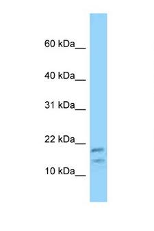 DBI / ACBD1 Antibody - DBI antibody Western blot of HT1080 Cell lysate. Antibody concentration 1 ug/ml.  This image was taken for the unconjugated form of this product. Other forms have not been tested.