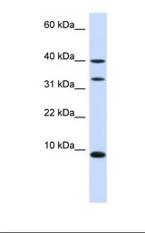 DBI / ACBD1 Antibody - Fetal liver lysate. Antibody concentration: 1.0 ug/ml. Gel concentration: 10-20%.  This image was taken for the unconjugated form of this product. Other forms have not been tested.
