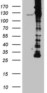 DBN1 / Drebrin Antibody - HEK293T cells were transfected with the pCMV6-ENTRY control. (Left lane) or pCMV6-ENTRY DBN1. (Right lane) cDNA for 48 hrs and lysed