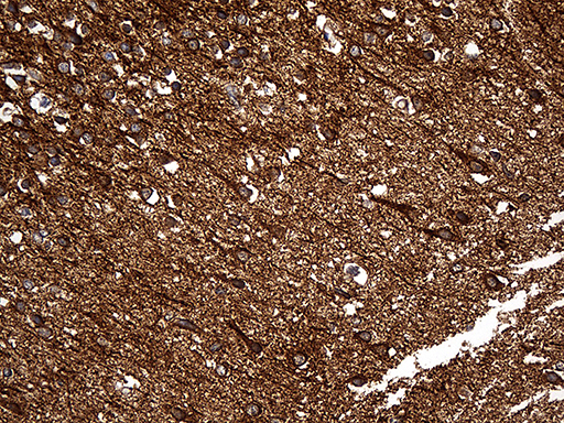 DBN1 / Drebrin Antibody - Immunohistochemical staining of paraffin-embedded Human adult brain tissue within the normal limits using anti-DBN1 mouse monoclonal antibody. (Heat-induced epitope retrieval by 1mM EDTA in 10mM Tris buffer. (pH8.5) at 120 oC for 3 min. (1:2000)