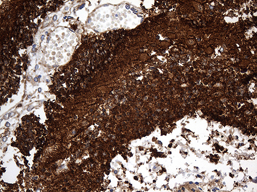 DBN1 / Drebrin Antibody - Immunohistochemical staining of paraffin-embedded Human embryonic cerebellum within the normal limits using anti-DBN1 mouse monoclonal antibody. (Heat-induced epitope retrieval by 1mM EDTA in 10mM Tris buffer. (pH8.5) at 120°C for 3 min. (1:2000)
