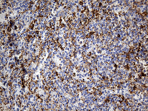 DBN1 / Drebrin Antibody - Immunohistochemical staining of paraffin-embedded Human spleen tissue within the normal limits using anti-DBN1 mouse monoclonal antibody. (Heat-induced epitope retrieval by 1mM EDTA in 10mM Tris buffer. (pH8.5) at 120°C for 3 min. (1:2000)