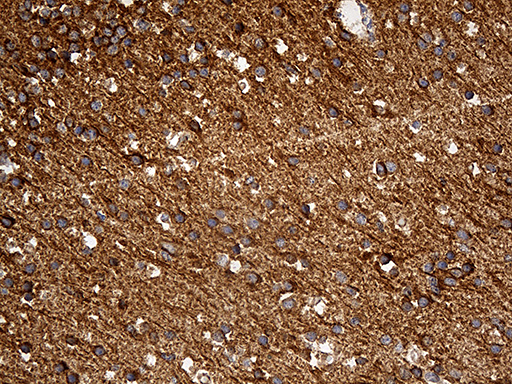 DBN1 / Drebrin Antibody - Immunohistochemical staining of paraffin-embedded Human adult brain tissue within the normal limits using anti-DBN1 mouse monoclonal antibody. (Heat-induced epitope retrieval by 1mM EDTA in 10mM Tris buffer. (pH8.5) at 120 oC for 3 min. (1:2000)
