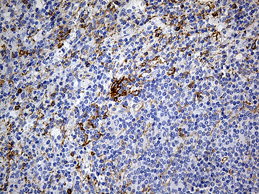 DBN1 / Drebrin Antibody - Immunohistochemical staining of paraffin-embedded Human spleen tissue within the normal limits using anti-DBN1 mouse monoclonal antibody. (Heat-induced epitope retrieval by 1mM EDTA in 10mM Tris buffer. (pH8.5) at 120°C for 3 min. (1:2000)