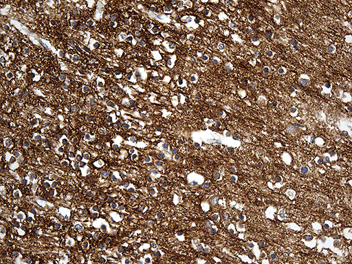 DBN1 / Drebrin Antibody - Immunohistochemical staining of paraffin-embedded Human adult brain tissue within the normal limits using anti-DBN1 mouse monoclonal antibody. (Heat-induced epitope retrieval by 1mM EDTA in 10mM Tris buffer. (pH8.5) at 120 oC for 3 min. (1:500)