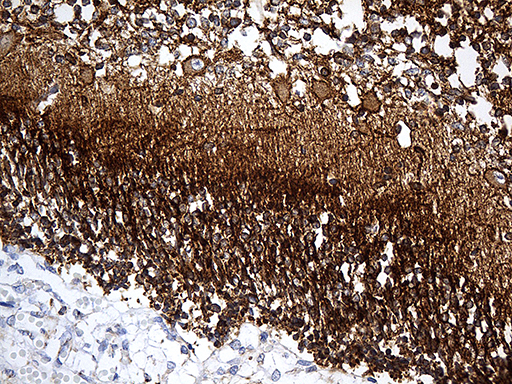 DBN1 / Drebrin Antibody - Immunohistochemical staining of paraffin-embedded Human embryonic cerebellum within the normal limits using anti-DBN1 mouse monoclonal antibody. (Heat-induced epitope retrieval by 1mM EDTA in 10mM Tris buffer. (pH8.5) at 120 oC for 3 min. (1:500)