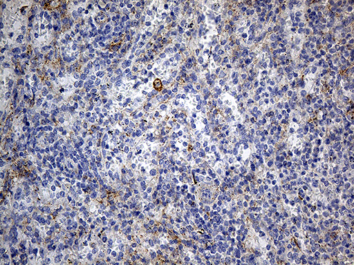 DBN1 / Drebrin Antibody - Immunohistochemical staining of paraffin-embedded Human spleen tissue within the normal limits using anti-DBN1 mouse monoclonal antibody. (Heat-induced epitope retrieval by 1mM EDTA in 10mM Tris buffer. (pH8.5) at 120°C for 3 min. (1:500)